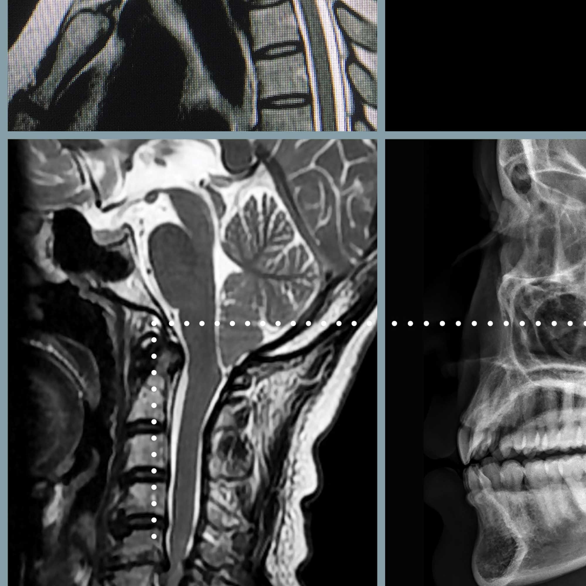 cervical pathology german zoom 02