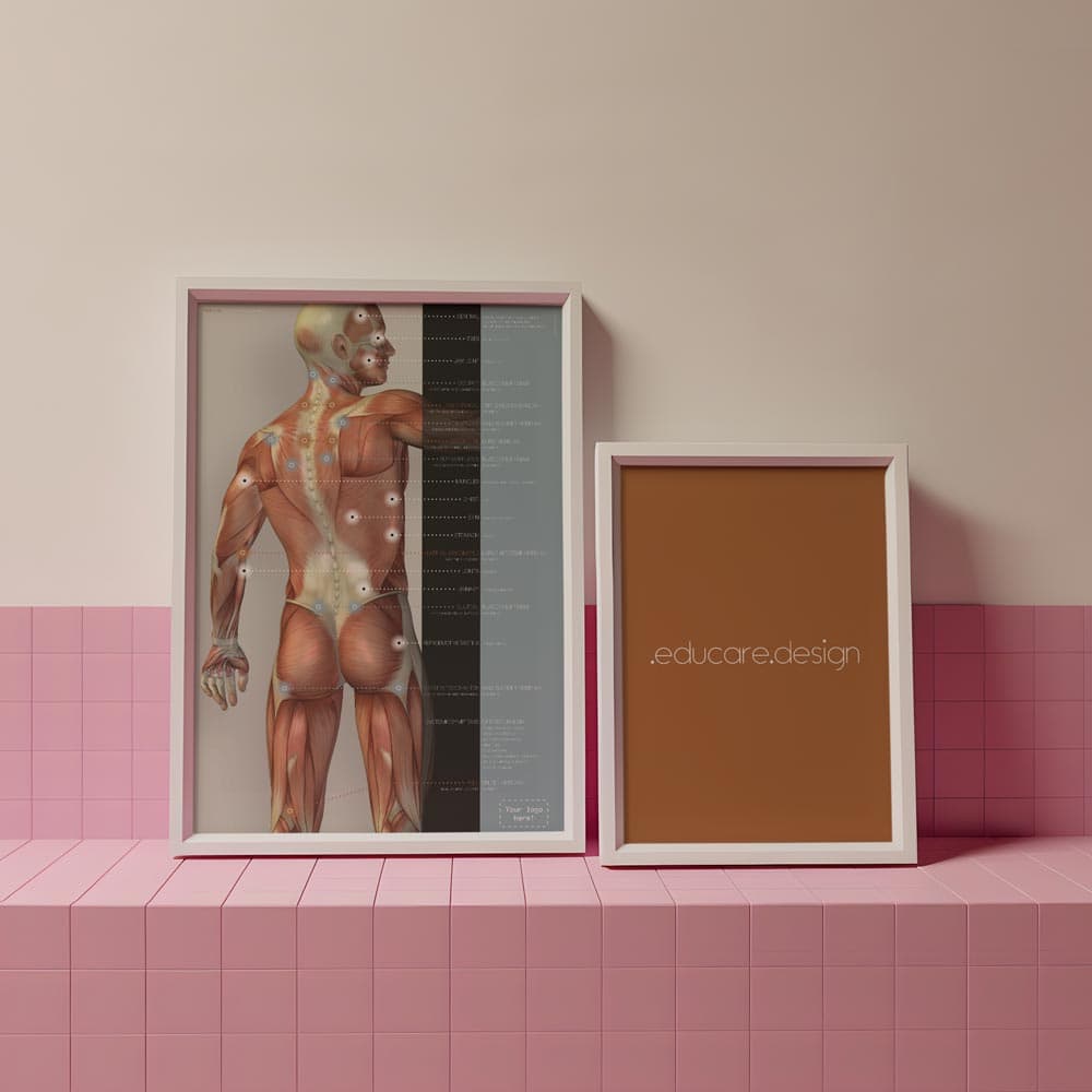 Fibromyalgia; Tender Points and Symptoms