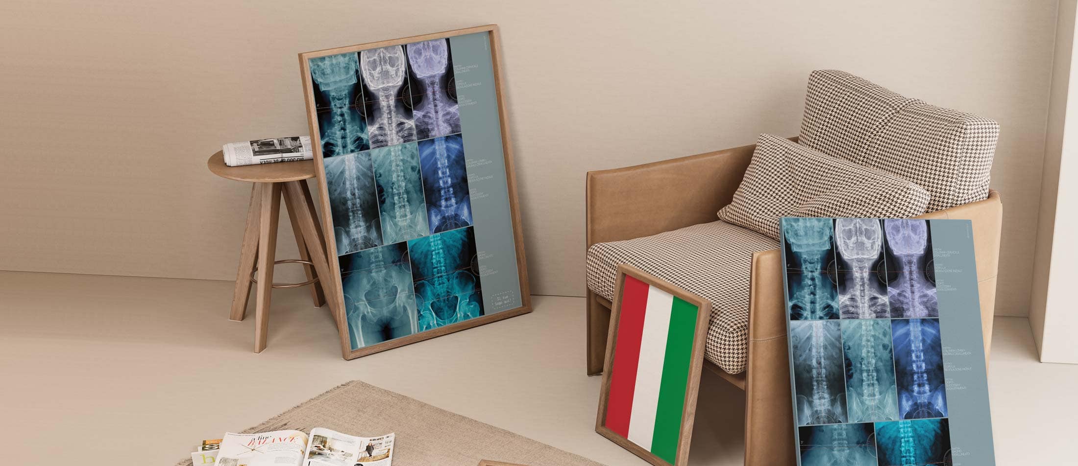 Disallineamento della Colonna Vertebrale