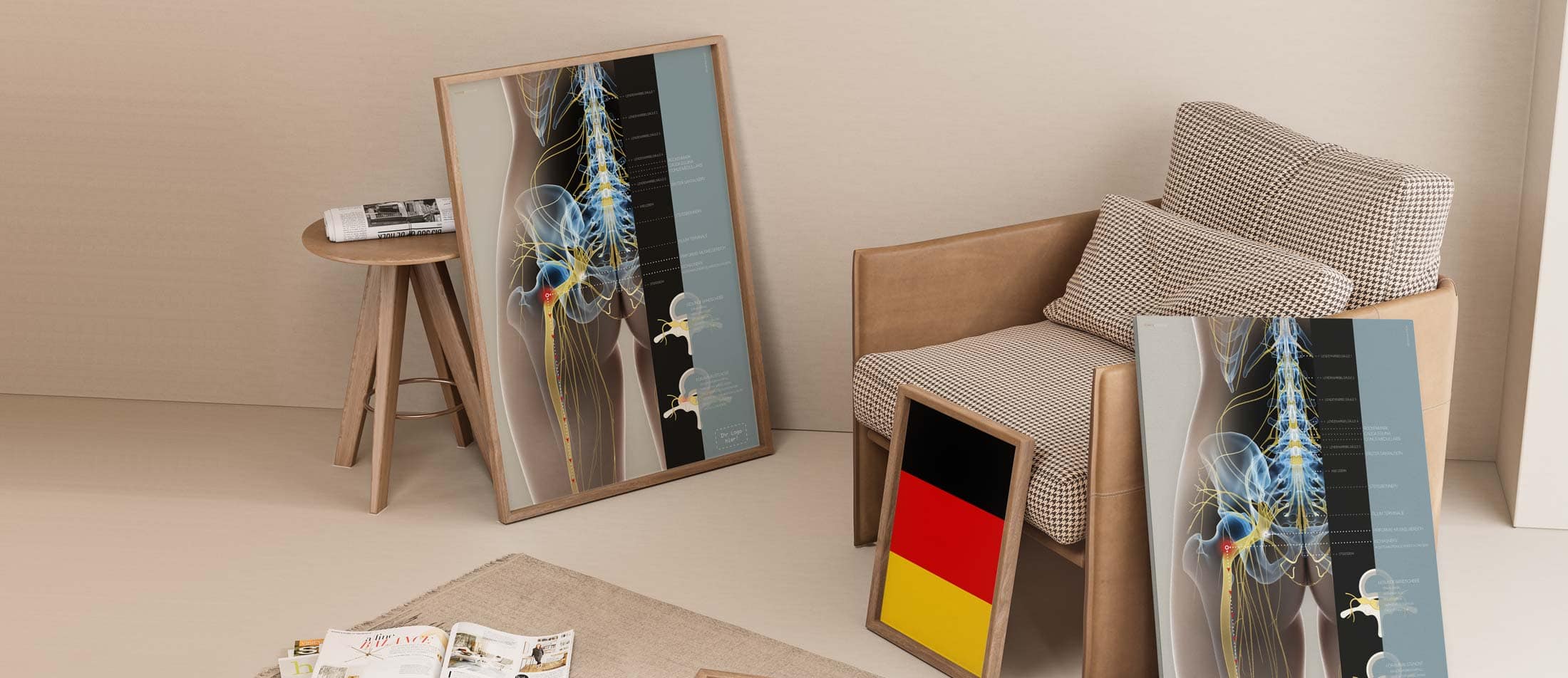 Ischias und Stenose