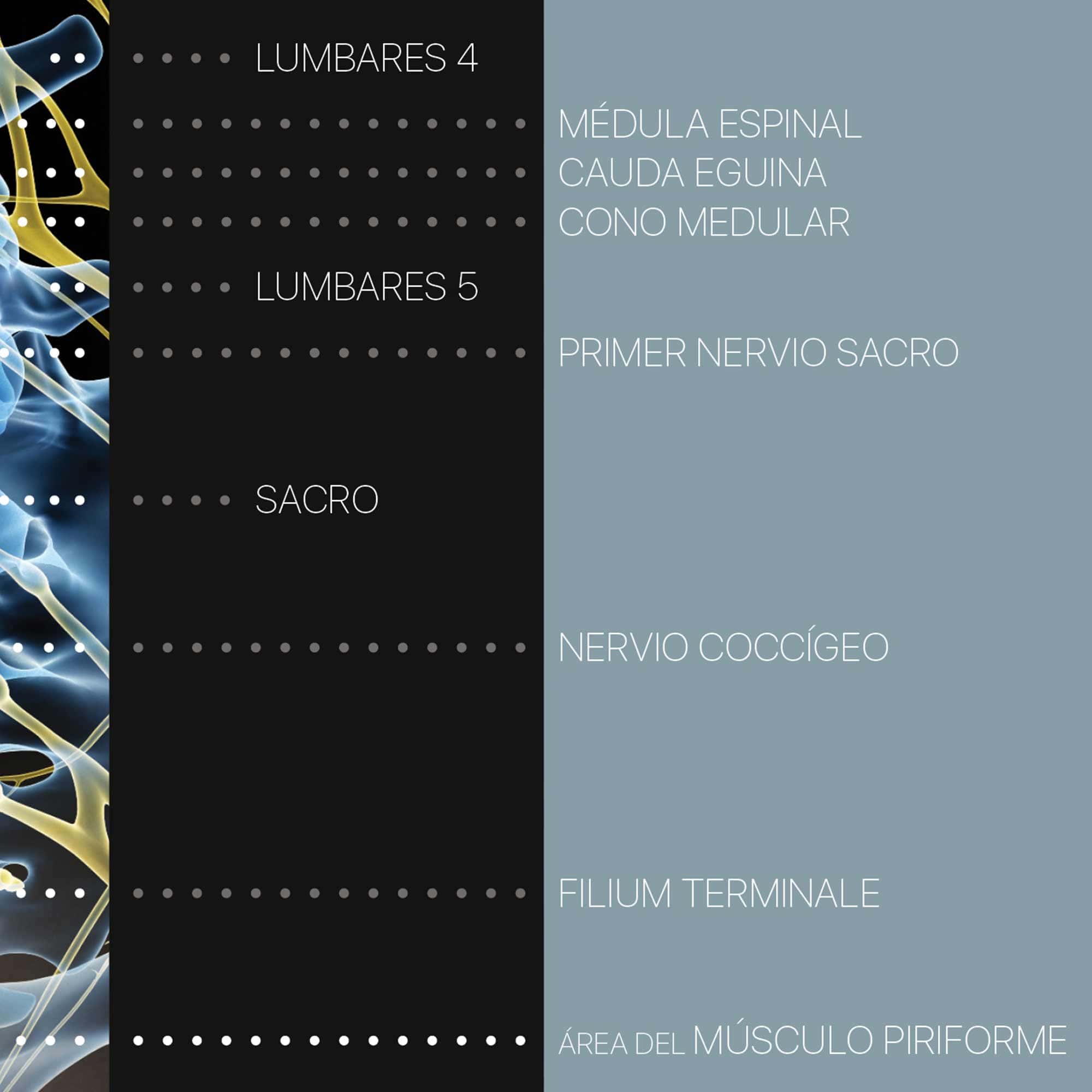 sciatica spanish zoom 01