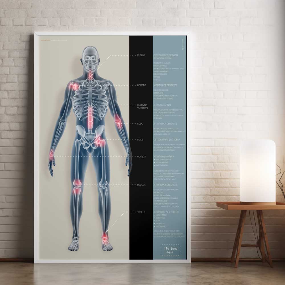 Osteoartritis