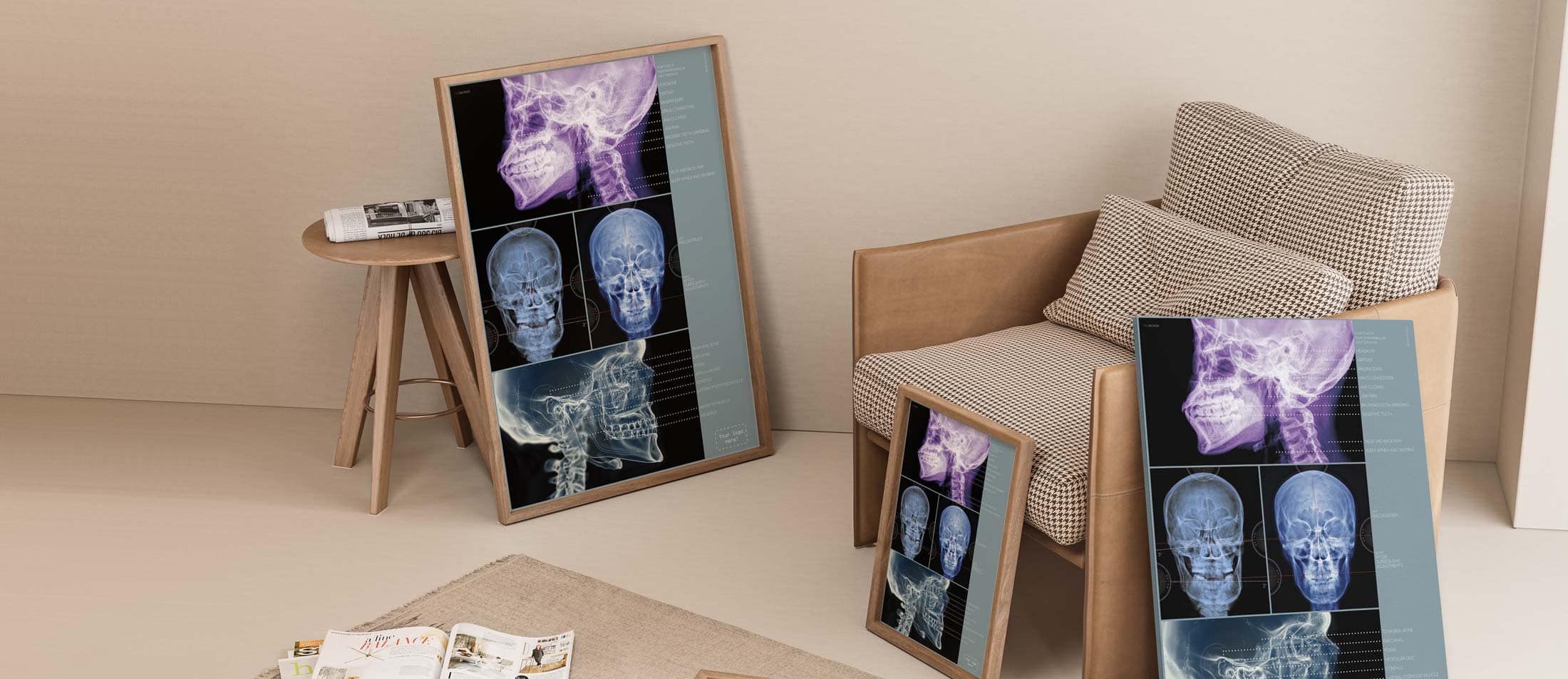 Temporomandibular Joint Disorder Artwork