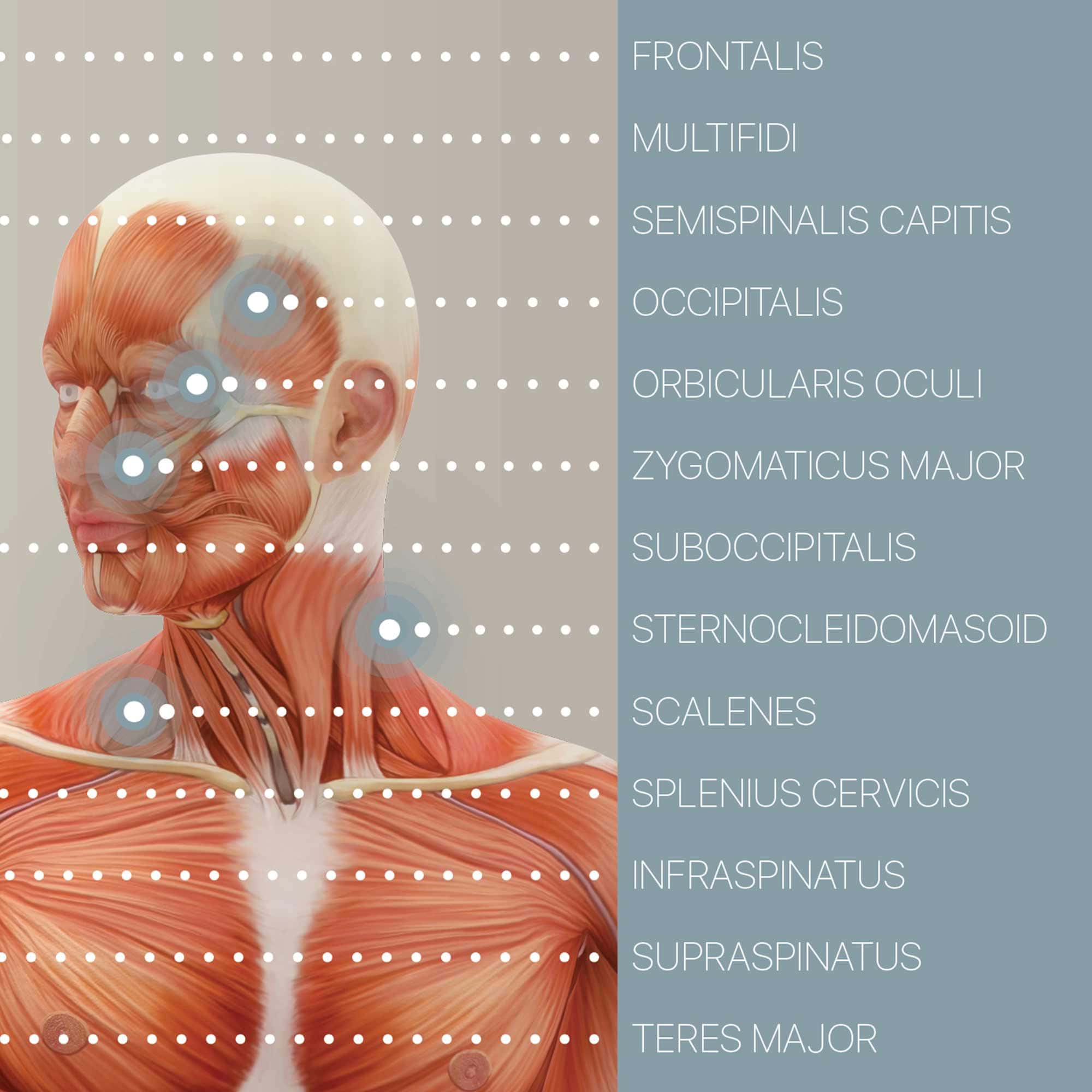 Myofascial Trigger Points Set