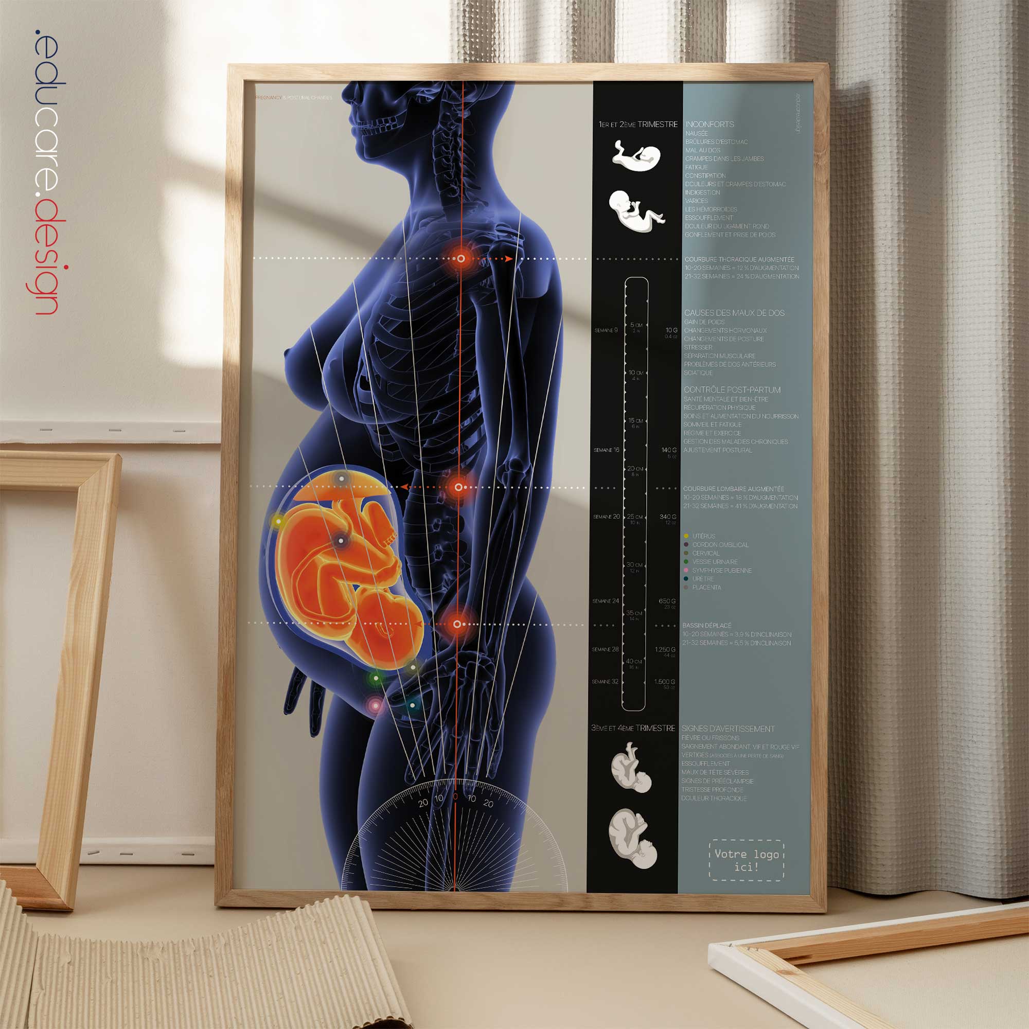 Grossesse et Changements Posturaux