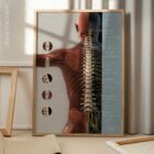 Complesso di Sublussazione Vertebrale