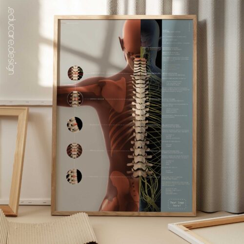 Complexe de Subluxation Vertébrale