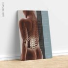 Spinal Subluxation Effects anatomy chart for clinics