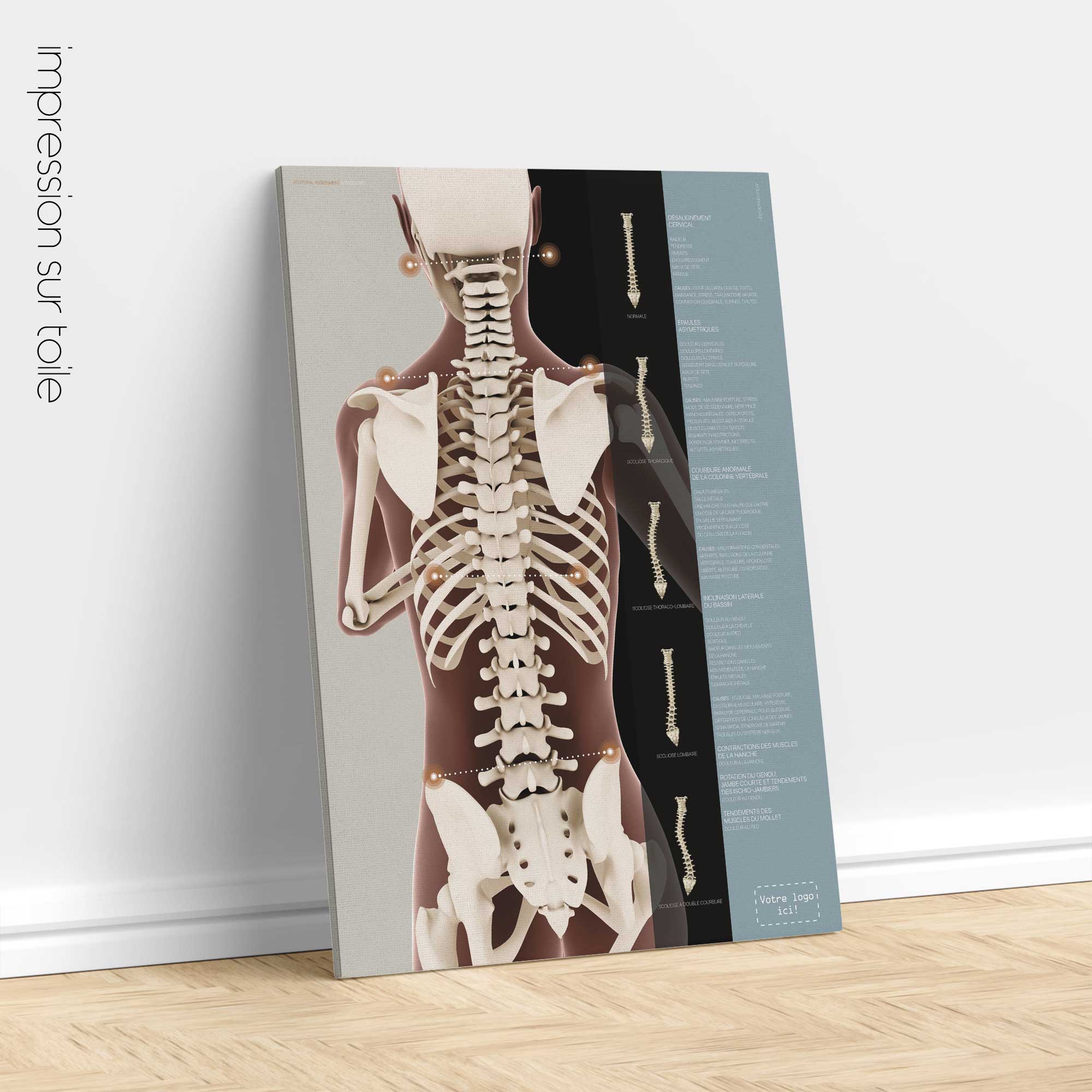 Postural Assessment and Scoliosis. Anatomy and physiology artwork from educare.design