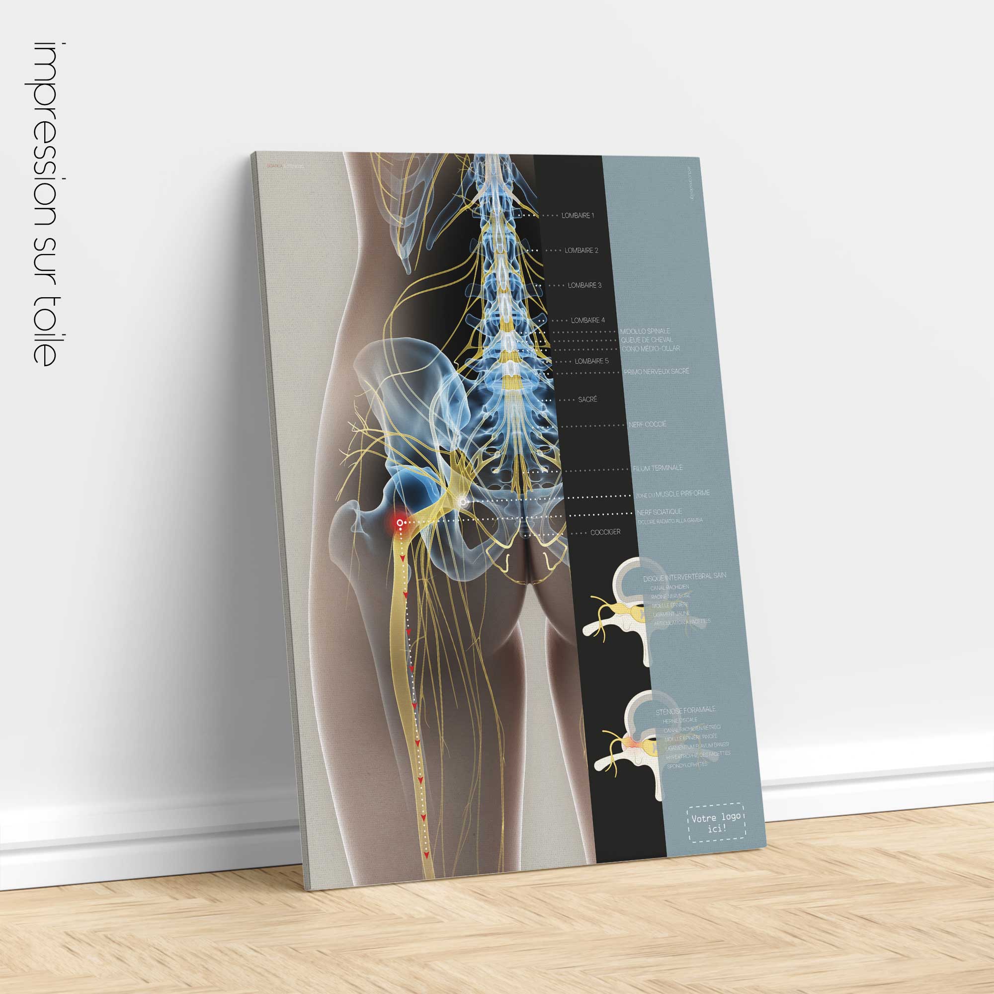Sciatica and stenosis artwork from educare.design