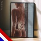 Effecten van Spinale Subluxatie anatomisch diagram voor praktijken en klinieken
