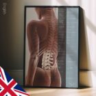 Spinal Subluxation Effects anatomy chart for clinics