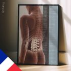 Effets de la Subluxation Vertébrale planche anatomique pour cabinets et cliniques