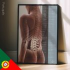 Efeitos da Subluxação Vertebral diagrama anatómico para clínicas e consultórios