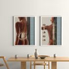 Spinal Subluxation Effects anatomy chart for clinics