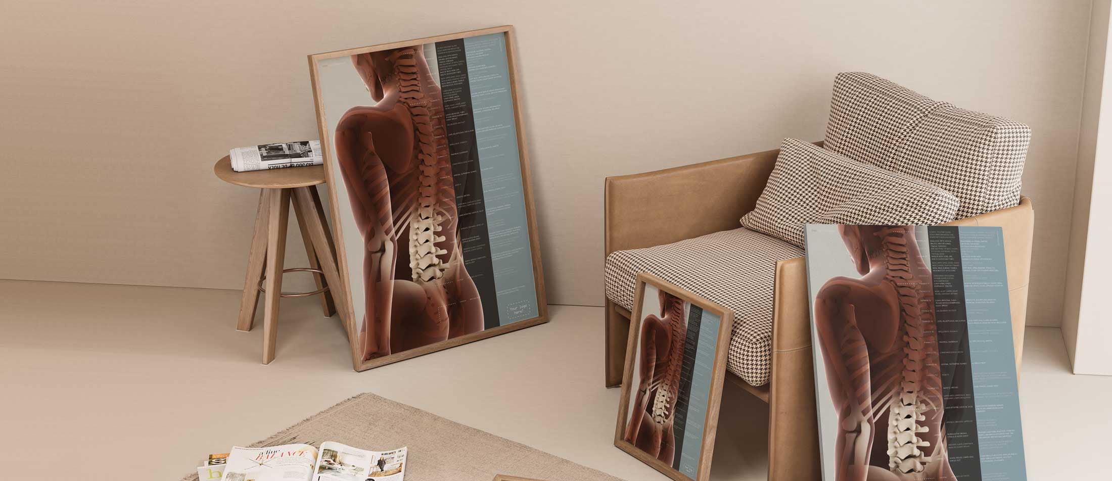 Subluxación vertebral Efectos Obra de arte