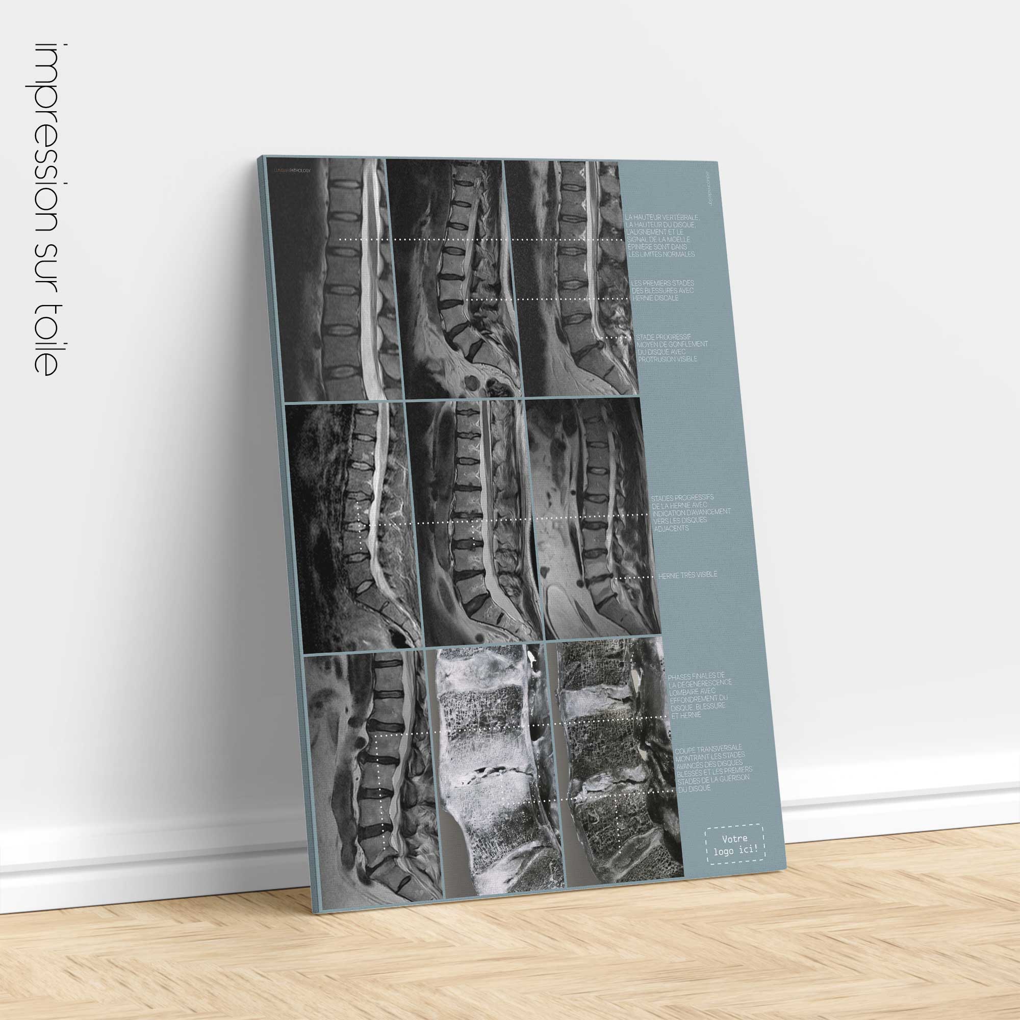 Lumbar Pathology artwork from educare.design