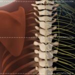 Complexe de Subluxation Vertébrale