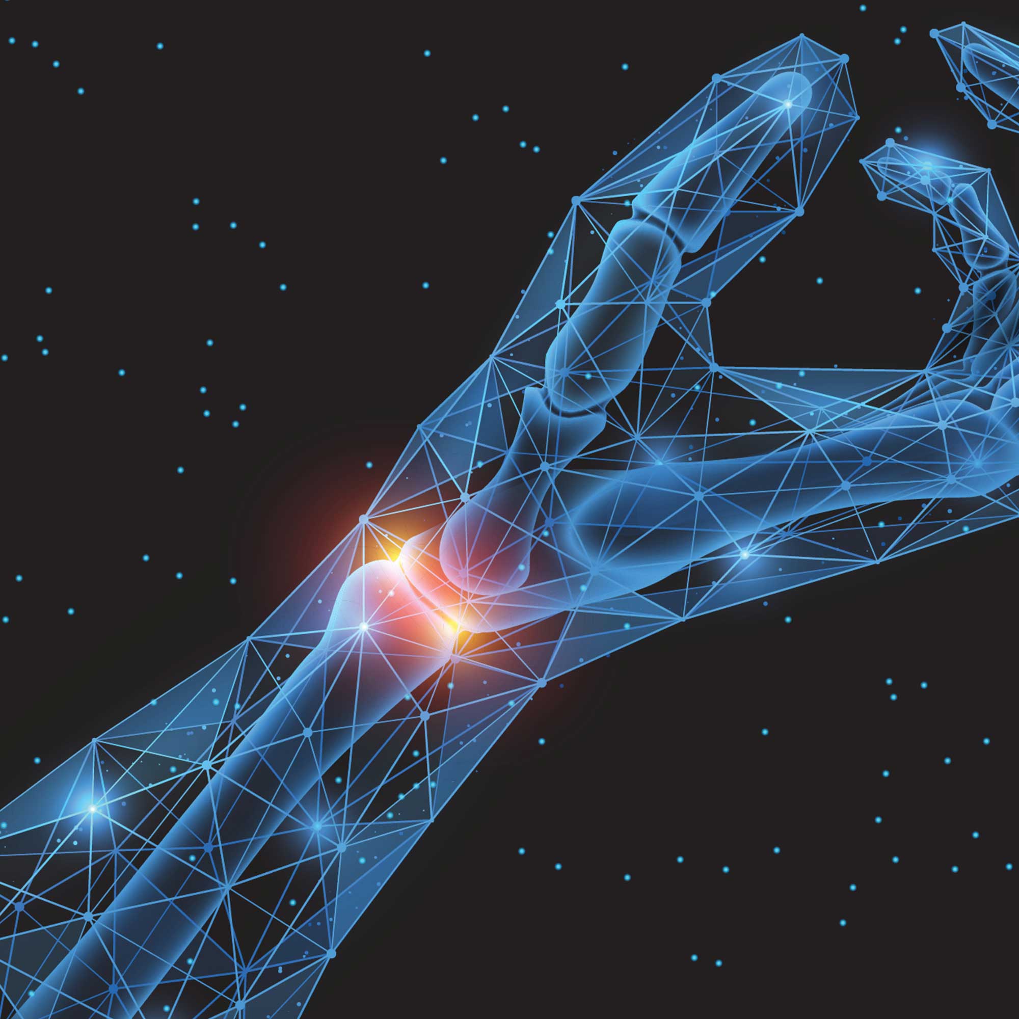 Carpal Tunnel Syndrome with Diagnosis and Exercises