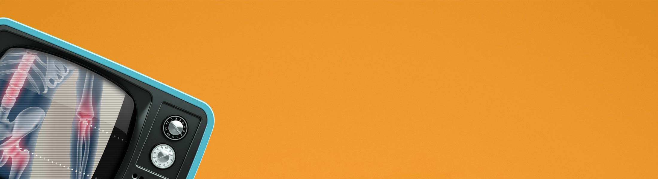 Video of Osteoarthritis