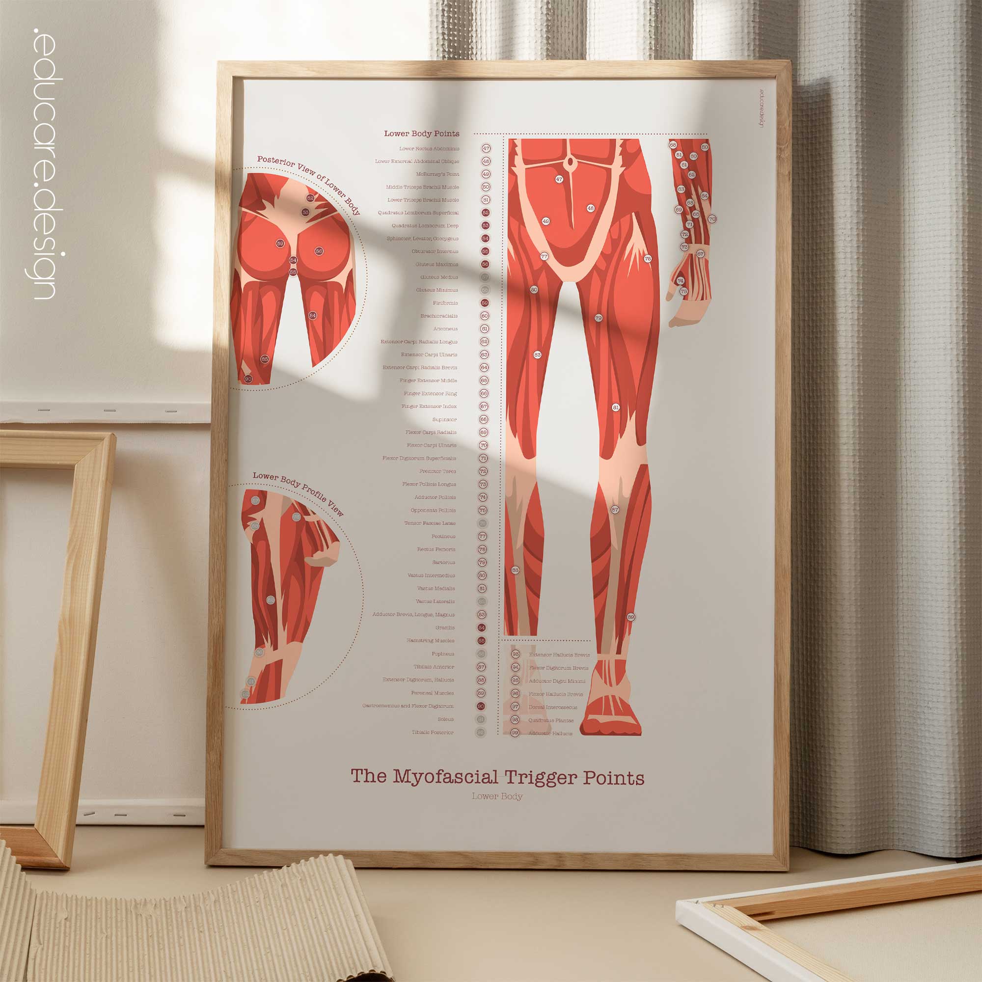 L'ensemble de Points de Déclenchement Myofasciaux