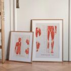 L'ensemble de Points de Déclenchement Myofasciaux