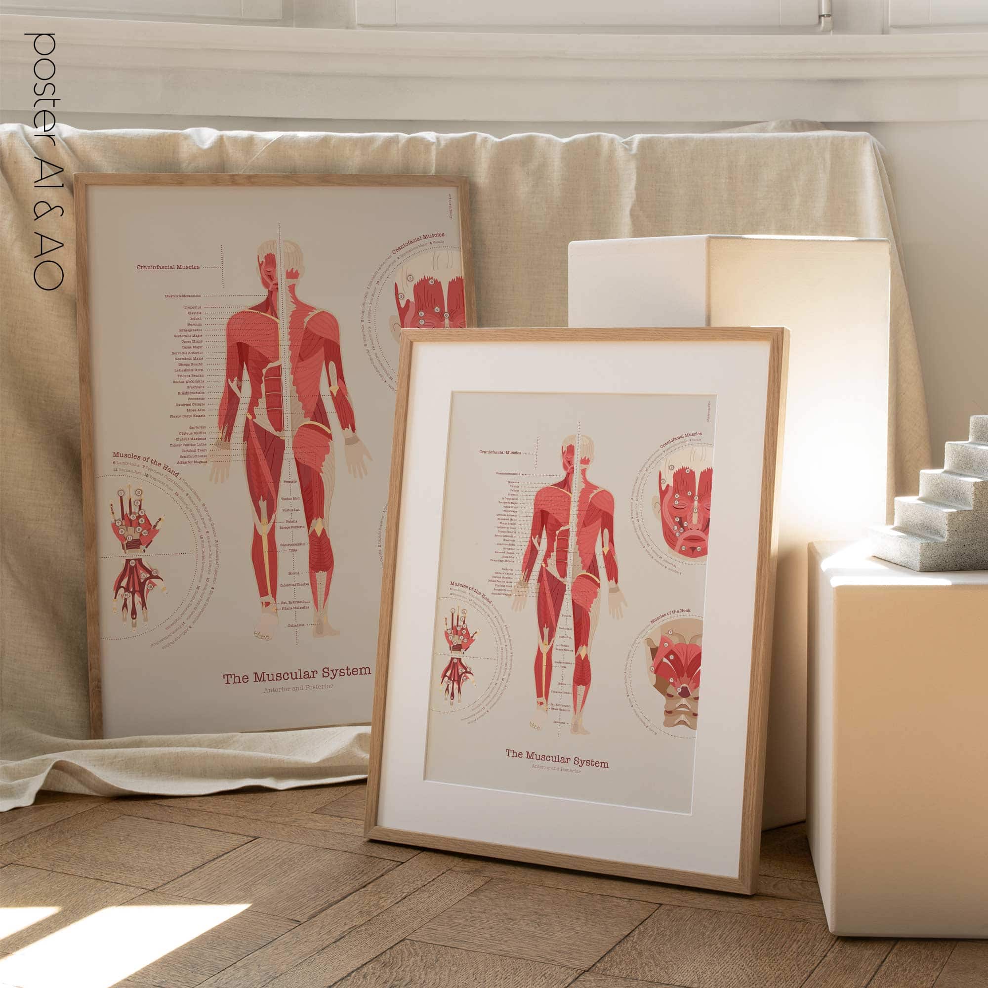 Mechanism of Sciatica