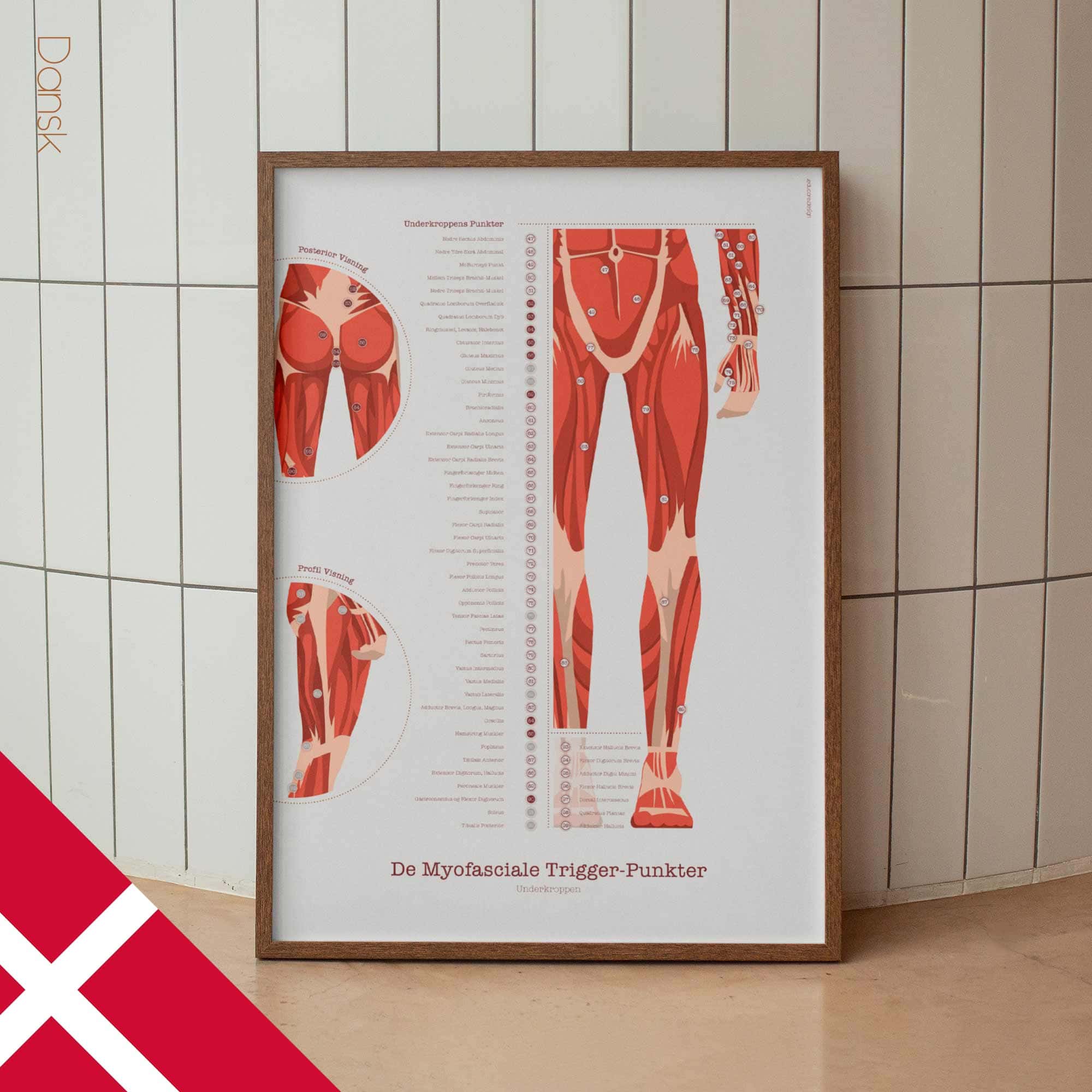 L'ensemble de Points de Déclenchement Myofasciaux