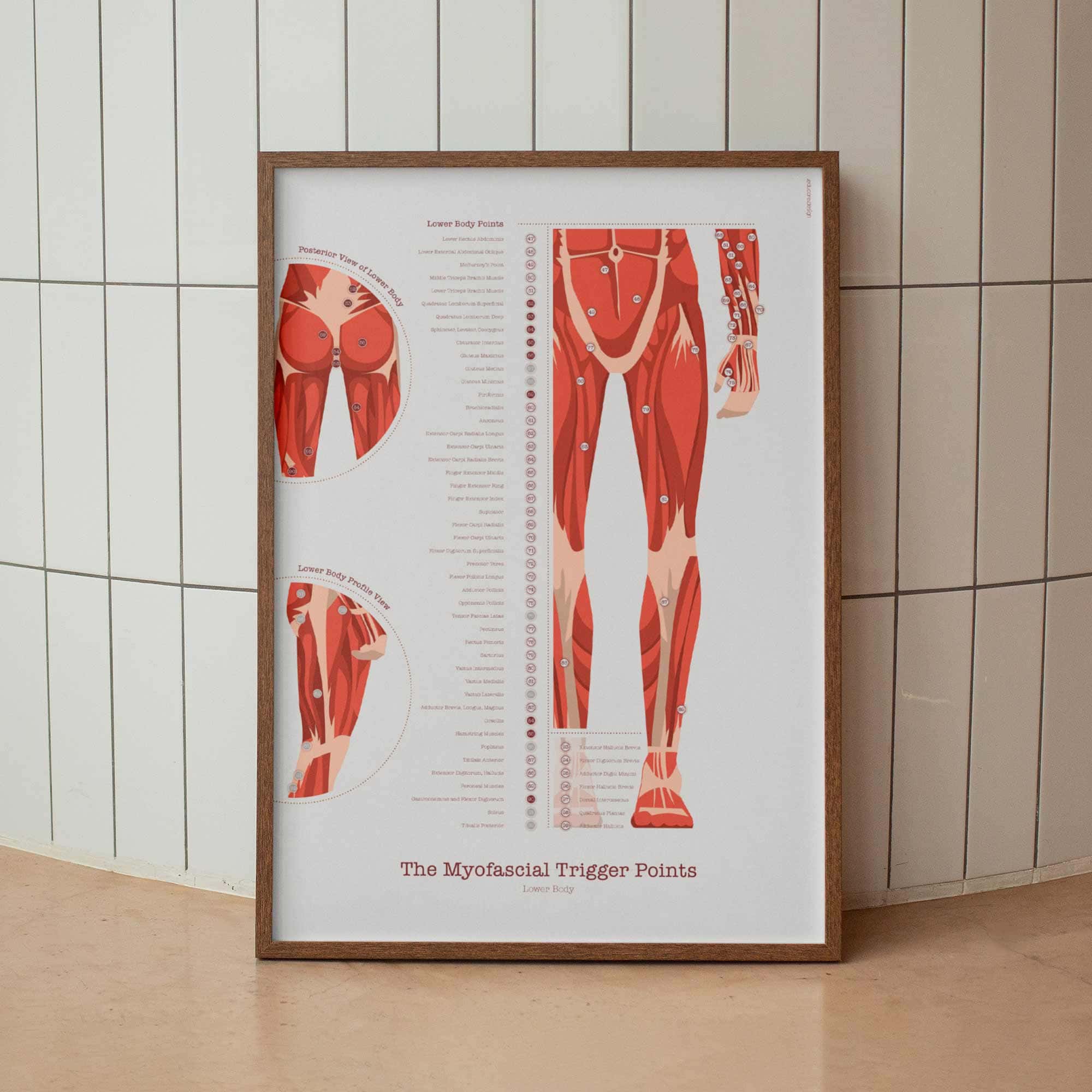 L'ensemble de Points de Déclenchement Myofasciaux