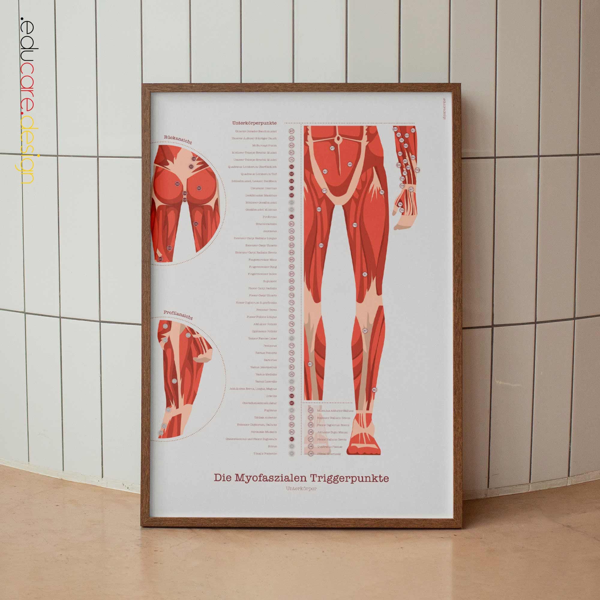 L'ensemble de Points de Déclenchement Myofasciaux