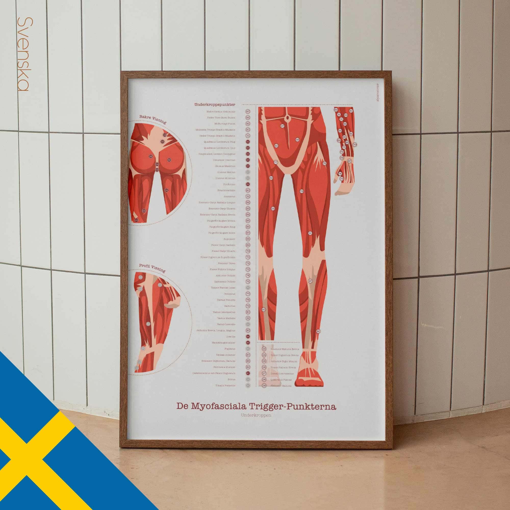 L'ensemble de Points de Déclenchement Myofasciaux