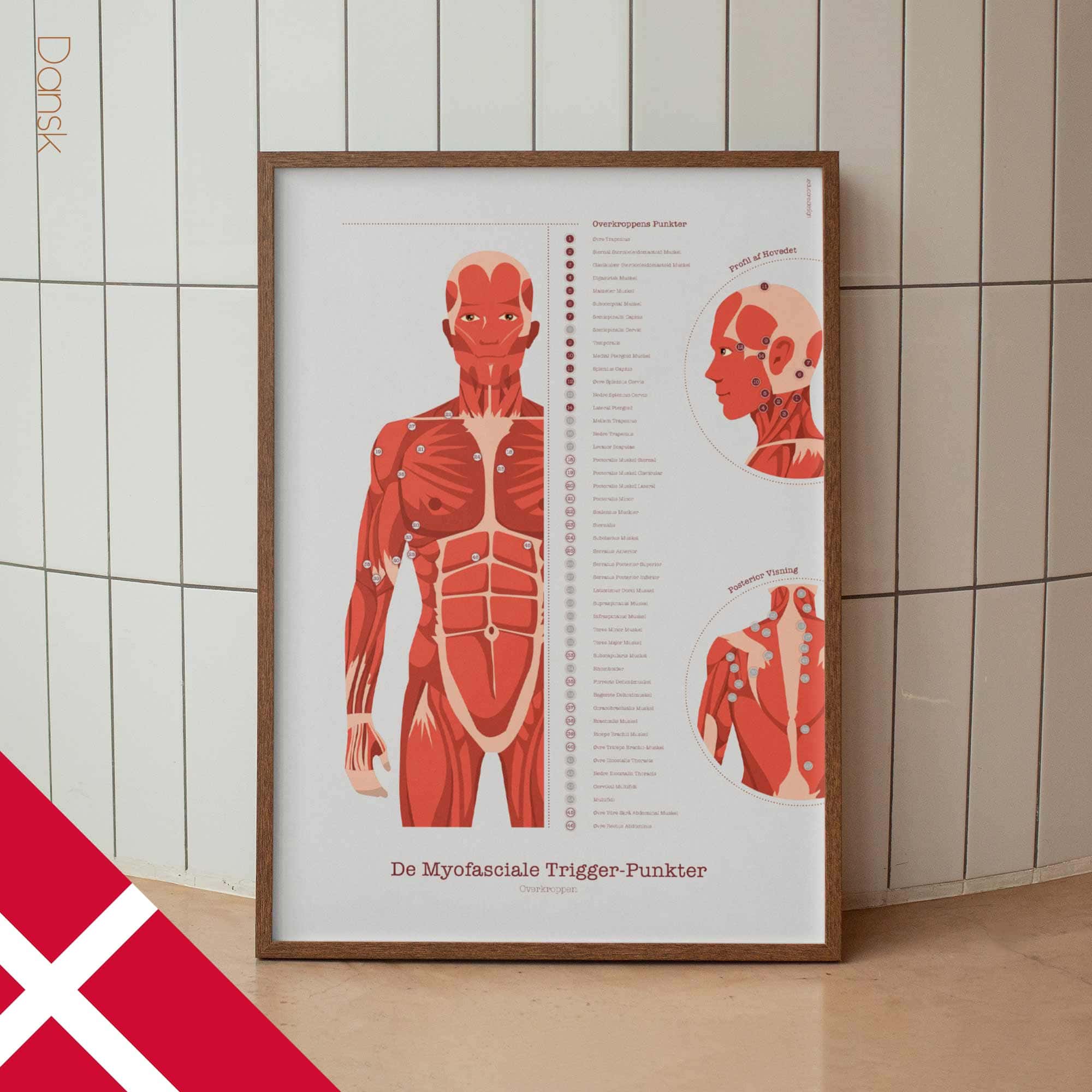 L'ensemble de Points de Déclenchement Myofasciaux