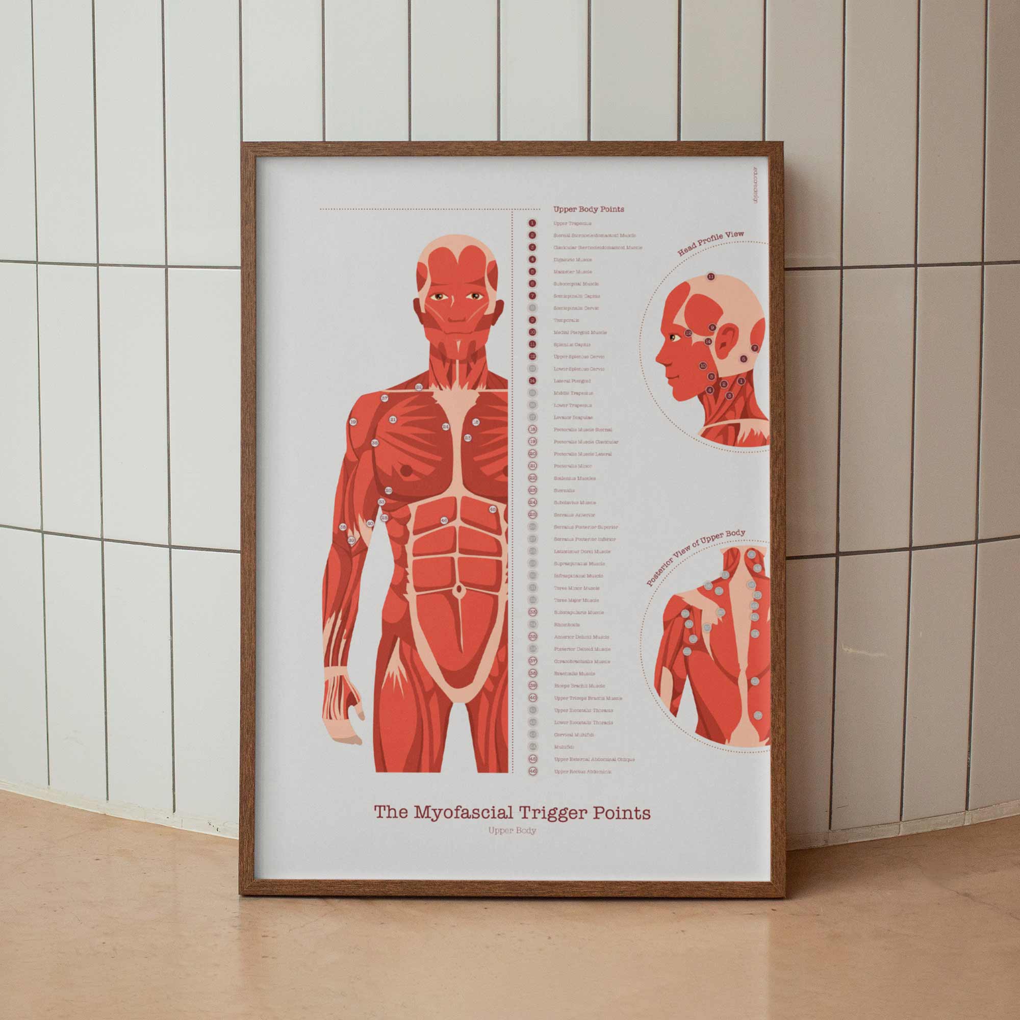 L'ensemble de Points de Déclenchement Myofasciaux