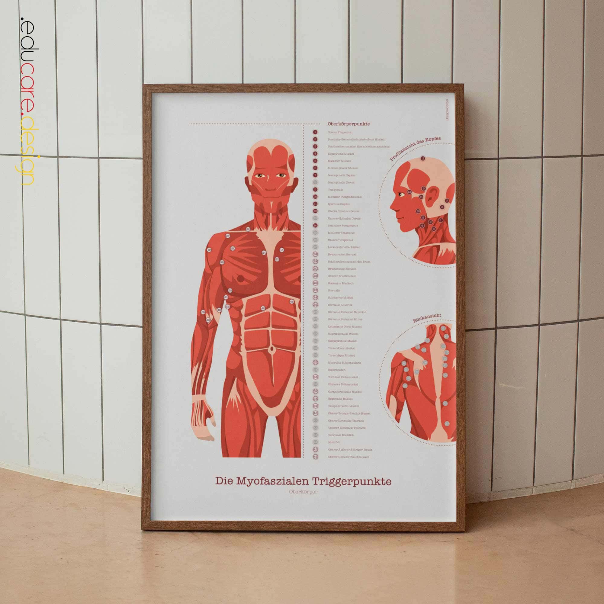 L'ensemble de Points de Déclenchement Myofasciaux