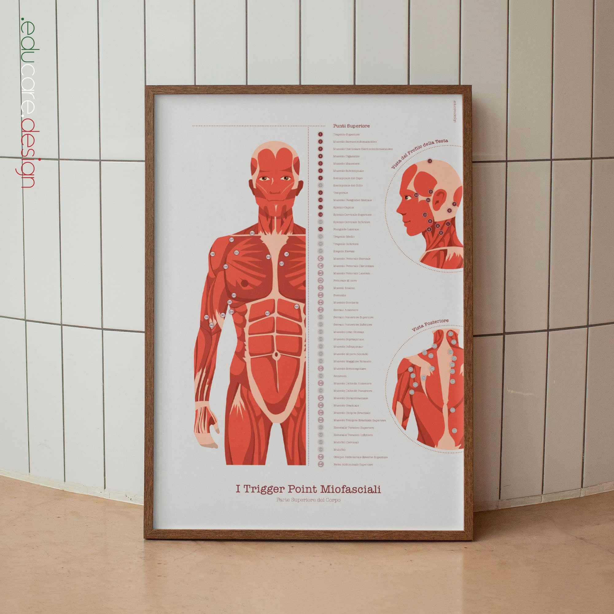 L'ensemble de Points de Déclenchement Myofasciaux