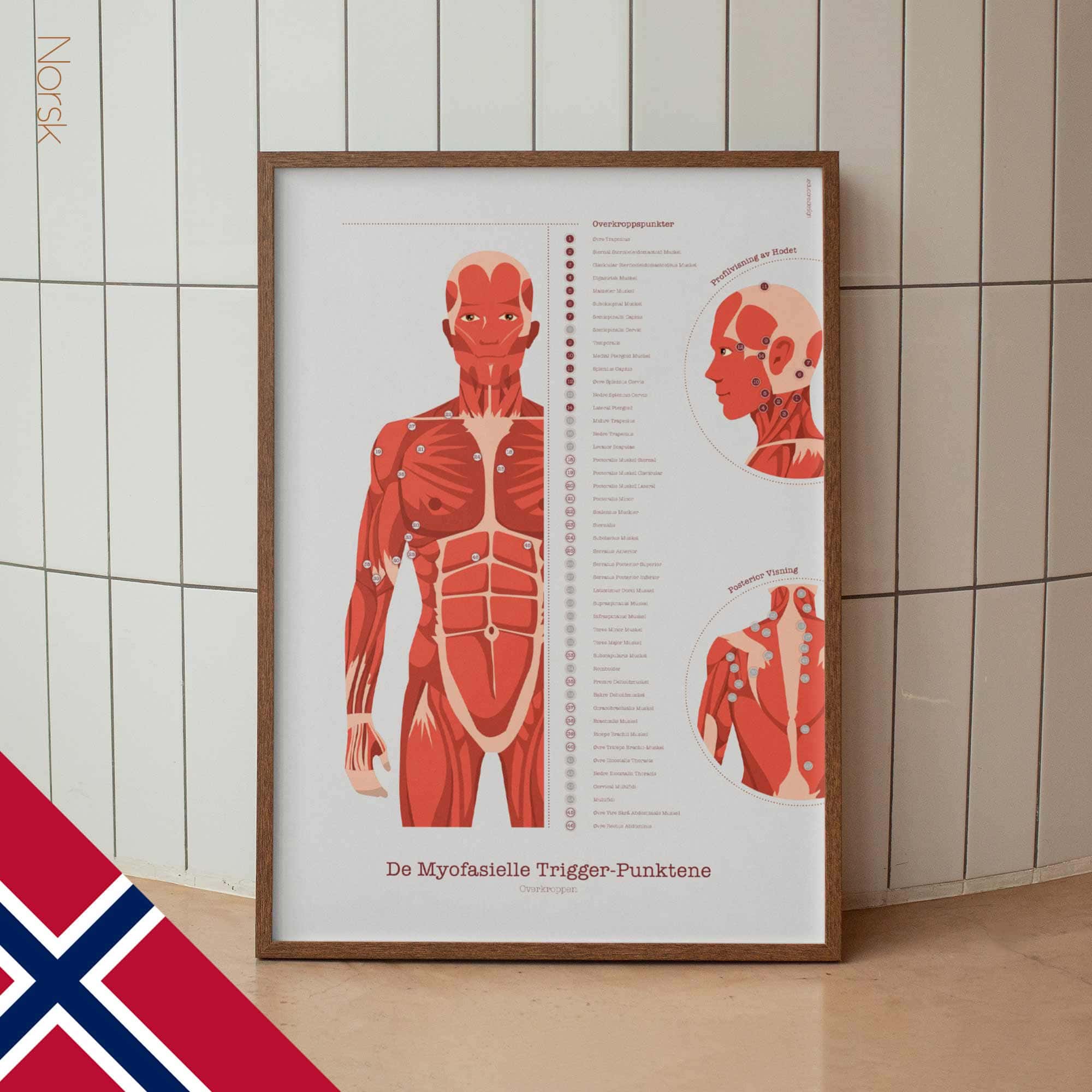 L'ensemble de Points de Déclenchement Myofasciaux