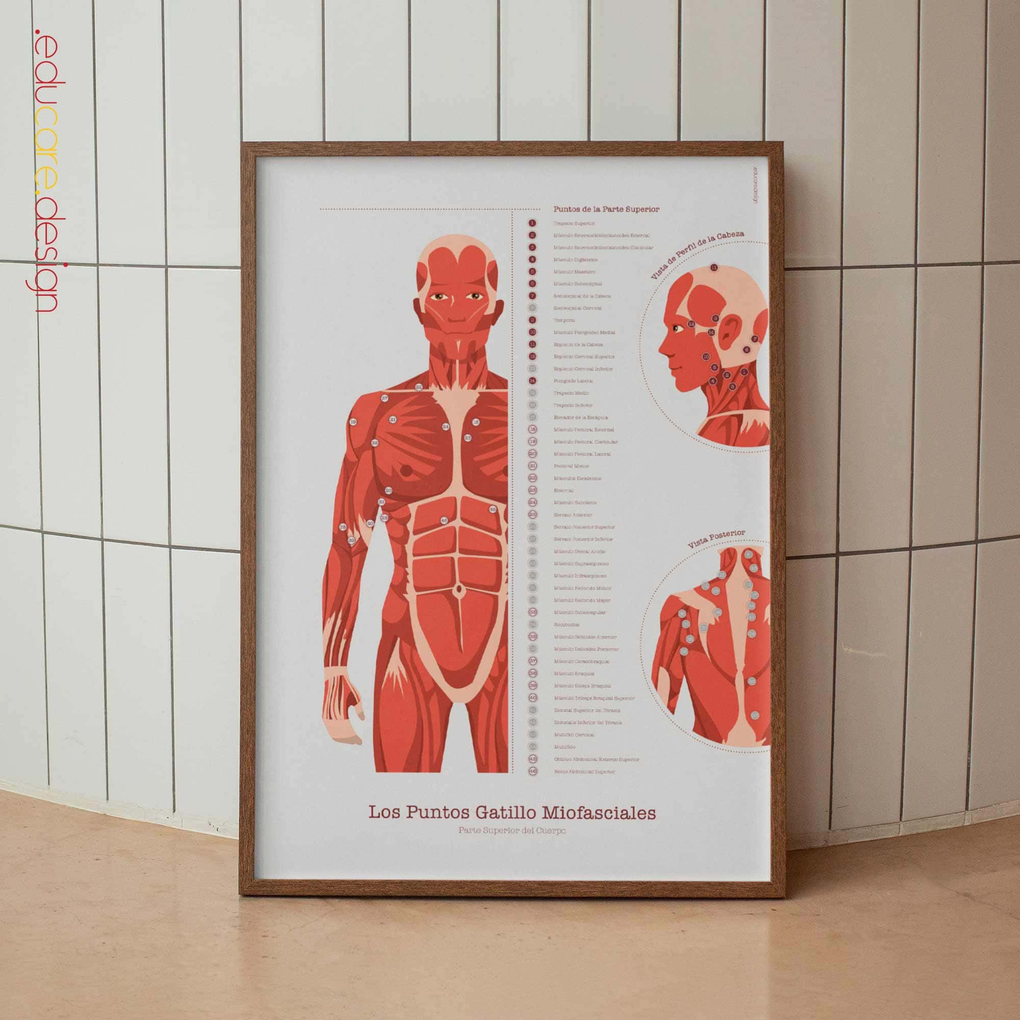 L'ensemble de Points de Déclenchement Myofasciaux