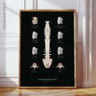 The Herniated Disc anatomy chart for clinics