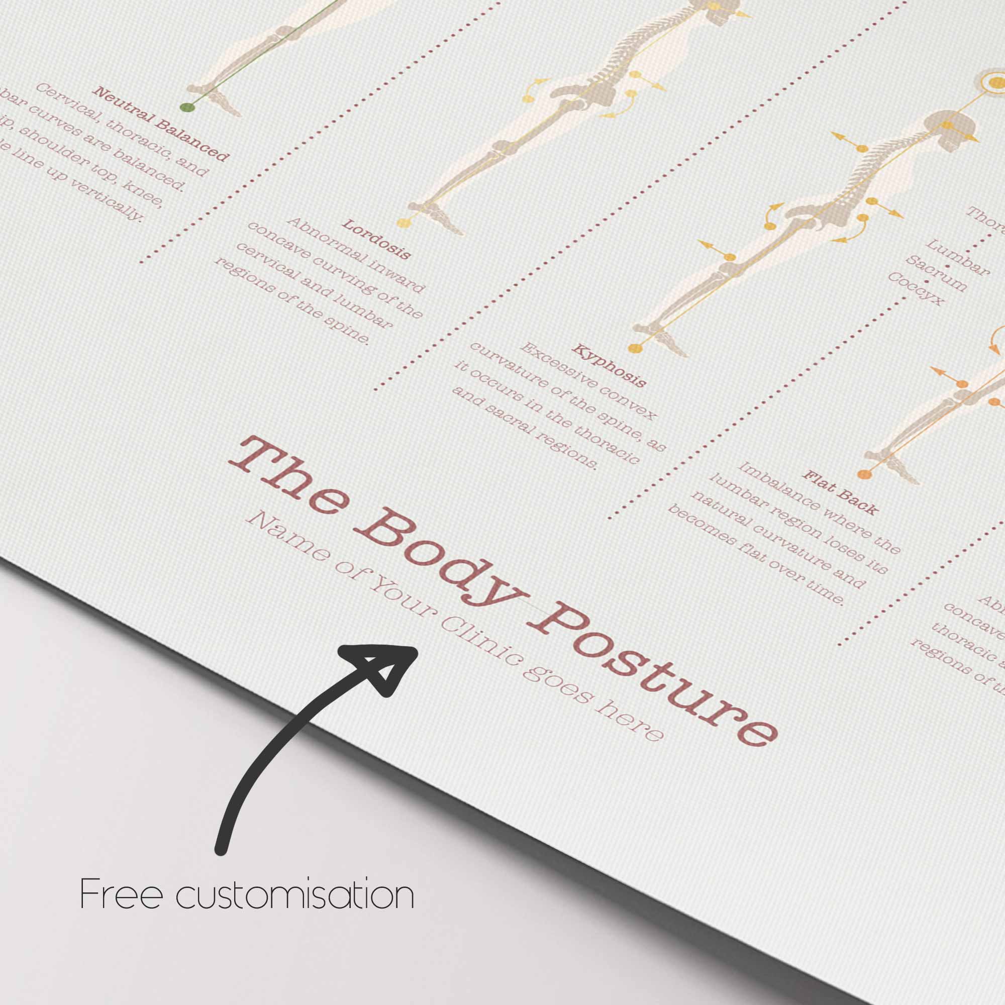 El Póster de la Postura