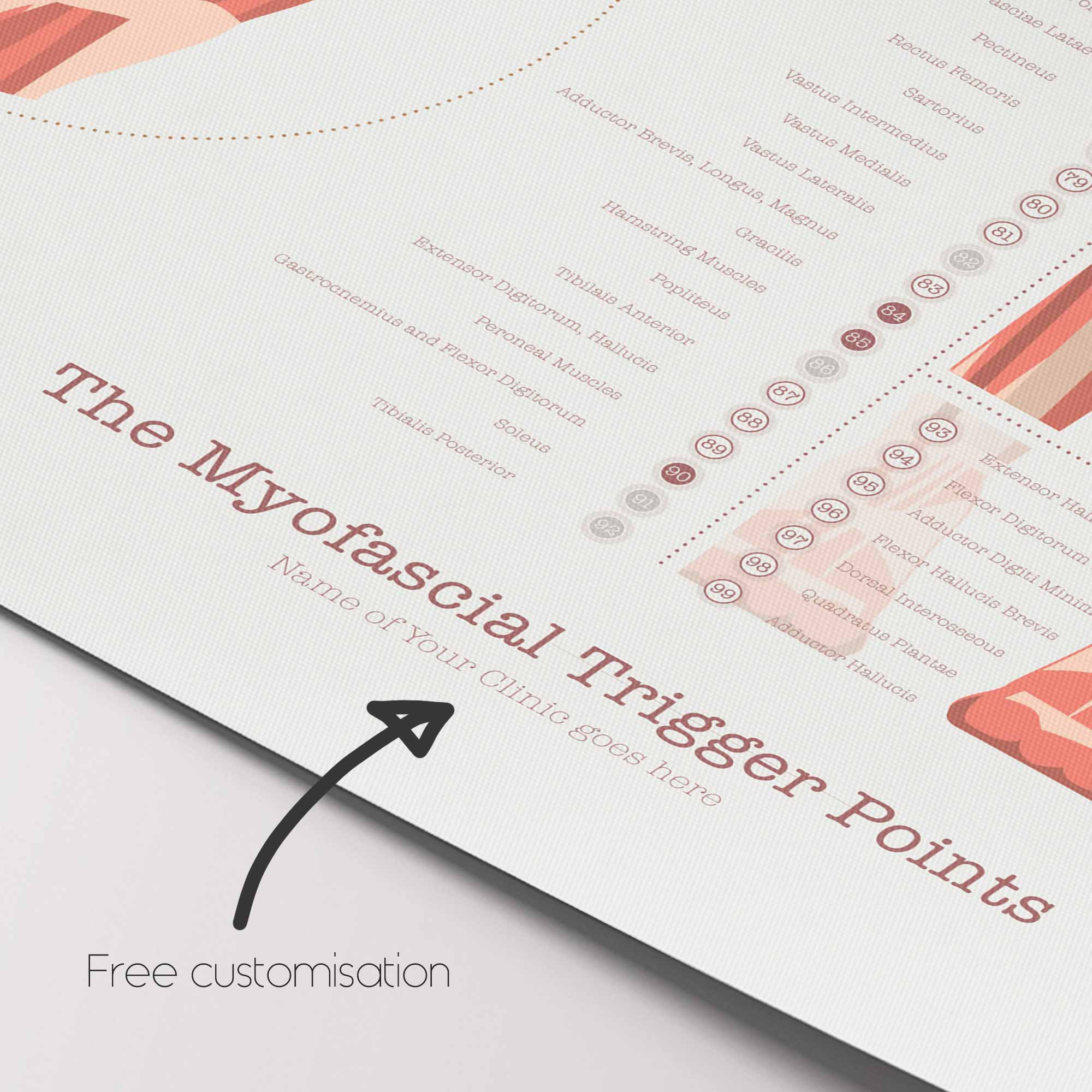 L'ensemble de Points de Déclenchement Myofasciaux