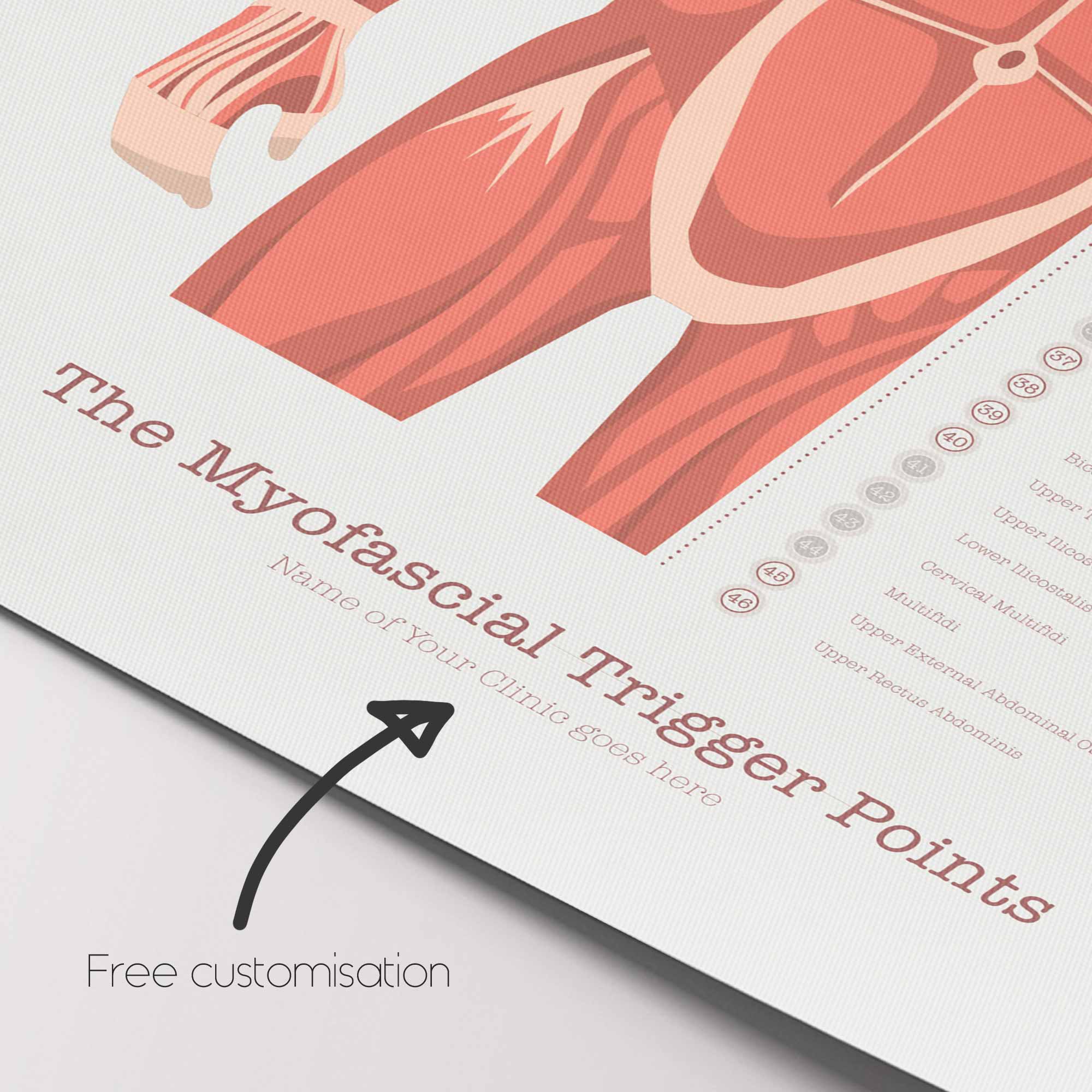 L'ensemble de Points de Déclenchement Myofasciaux