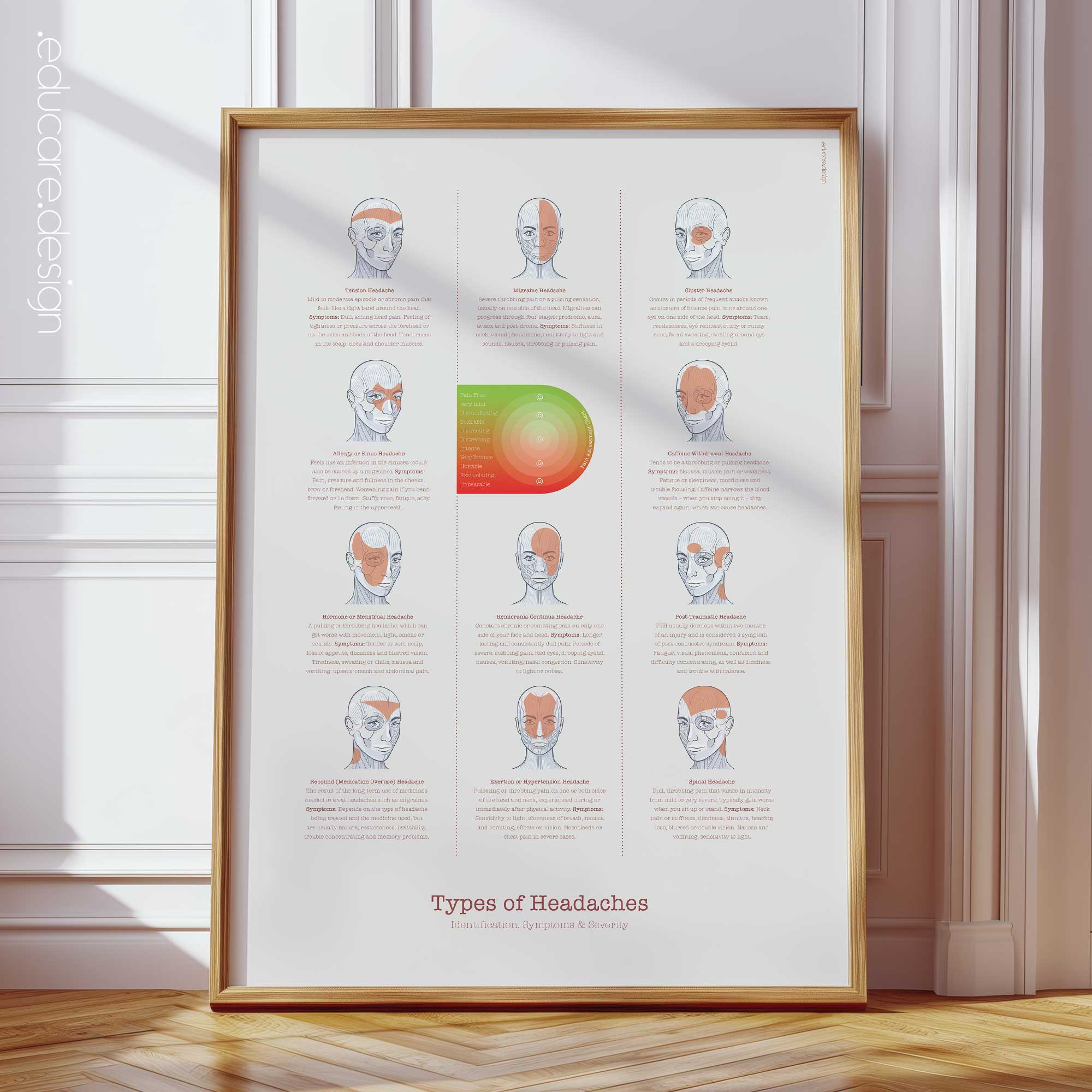 Types of Headaches — Preview