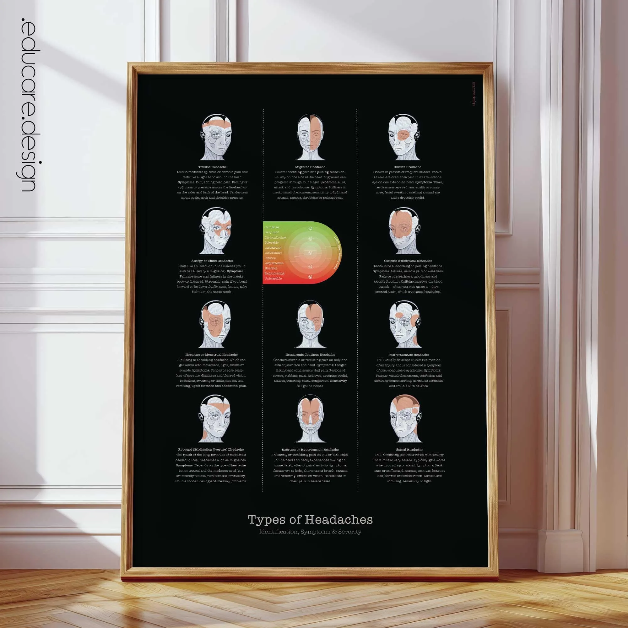 Types of Headaches anatomy chart for clinics