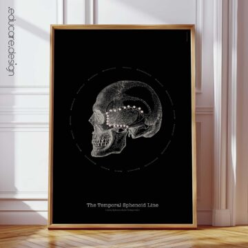 TS-Line Anatomy, Vintage Black Edition Chart