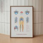 Mechanism of Sciatica anatomy chart for clinics