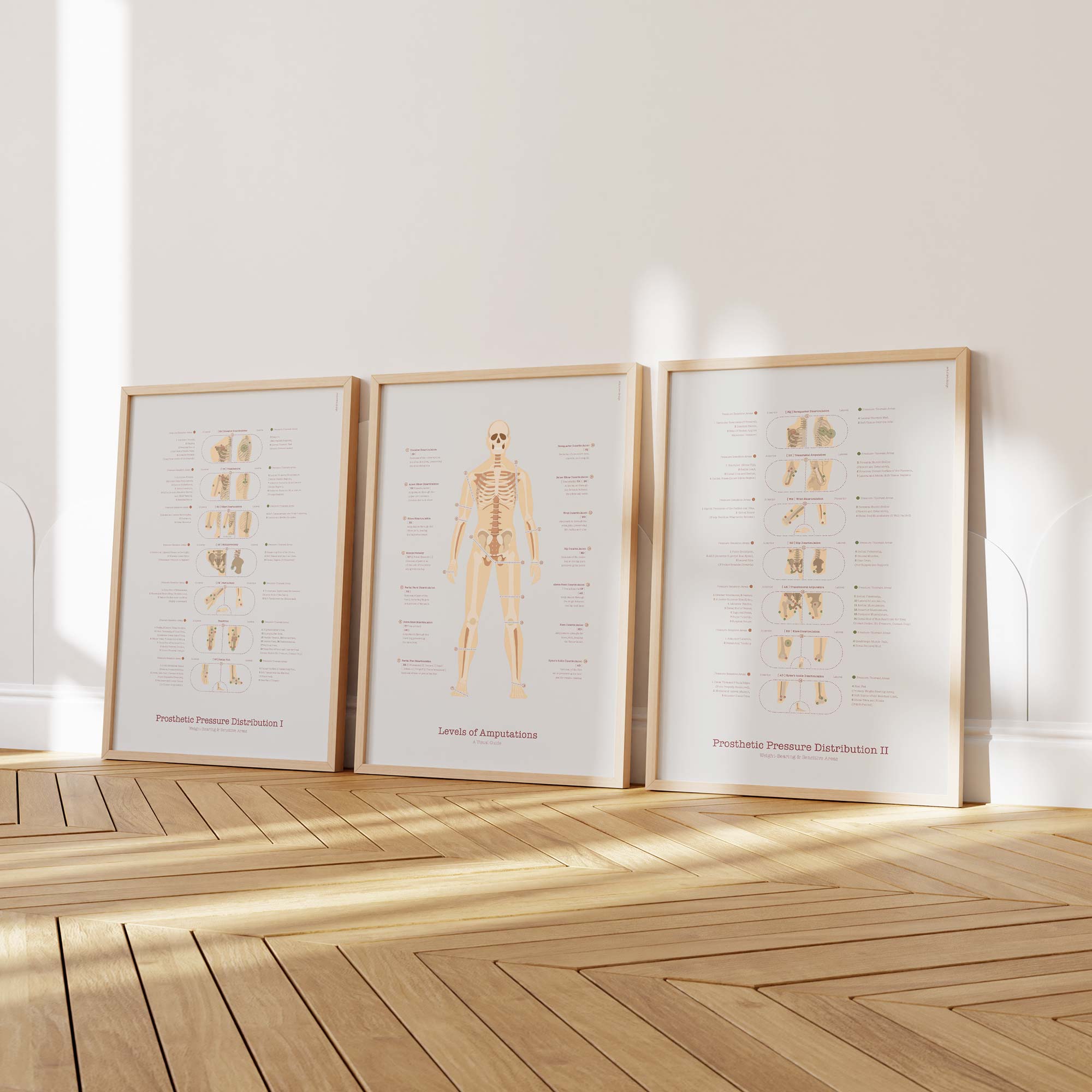 Amputations & Prosthetic Pressure Distribution