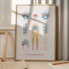 Mechanism of Sciatica anatomy chart for clinics