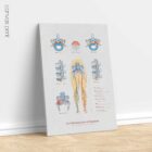 Mechanism of Sciatica anatomy chart for clinics