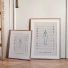 Bursitis, Arthritis and Tendonitis anatomy chart for clinics