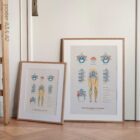 Mechanism of Sciatica anatomy chart for clinics
